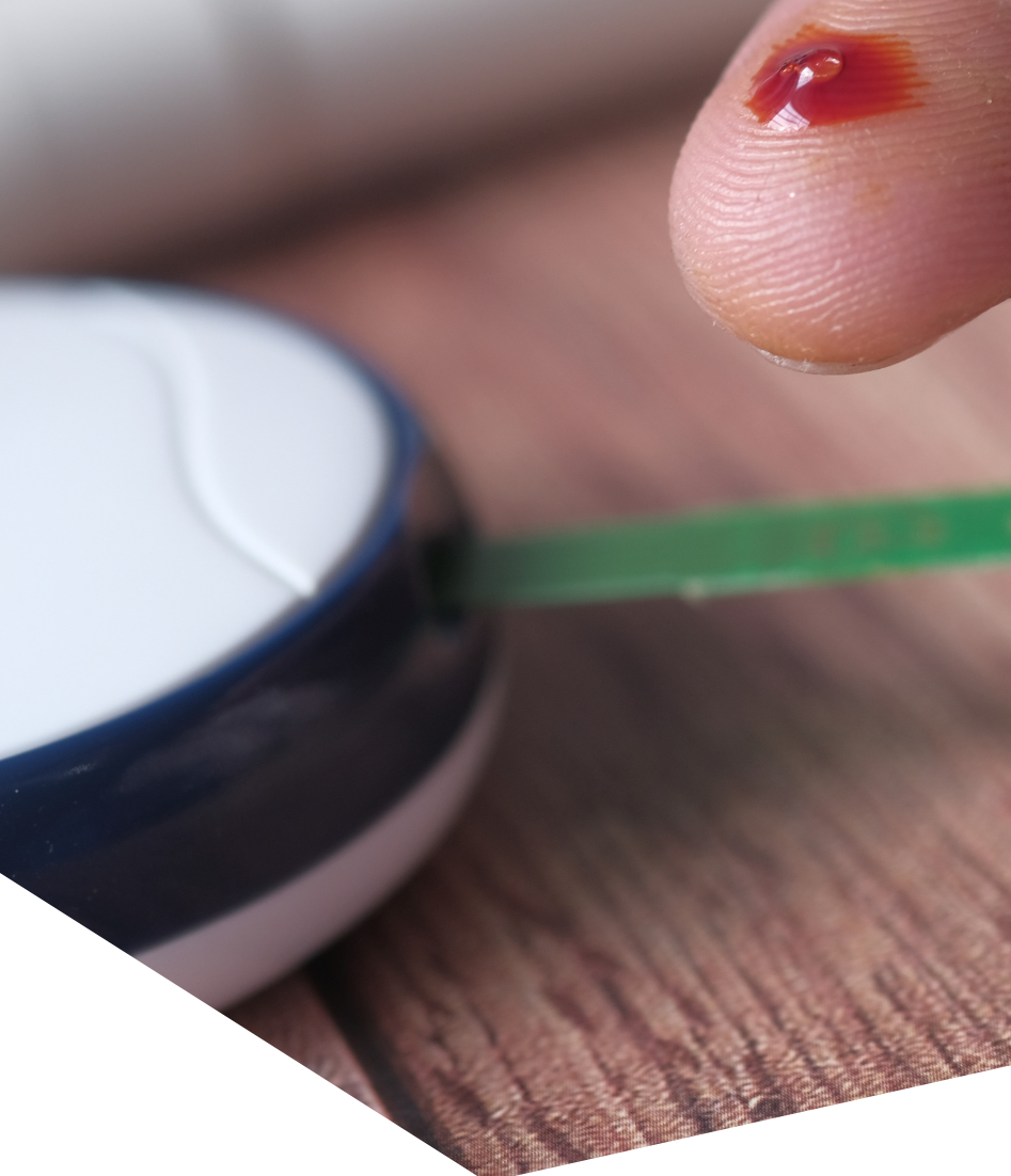 Finger-prick blood glucose test used in diabetes testing
