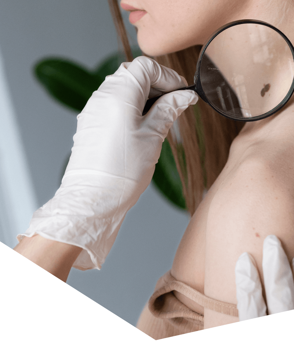 GP performing a skin cancer check at Kilcoy Medical Centre