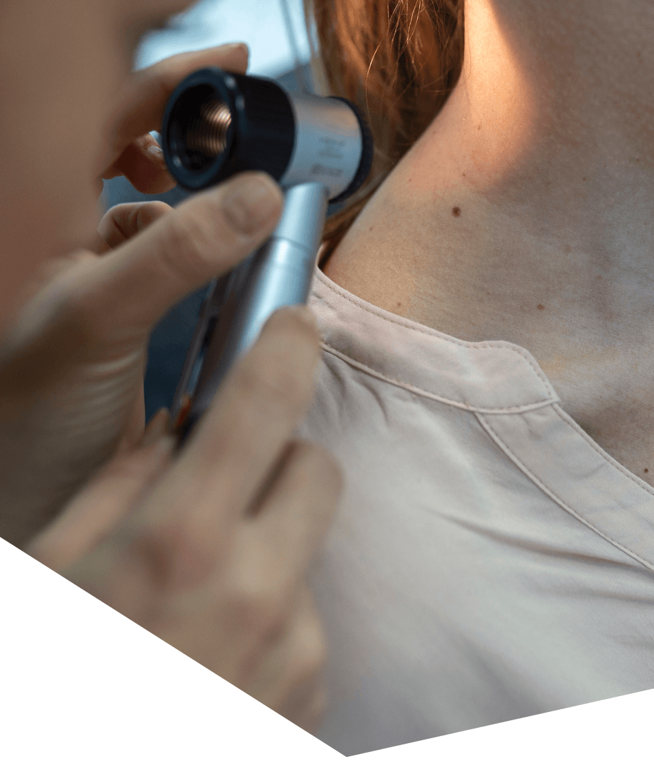 Patient discussing a changed mole with a GP in Kilcoy